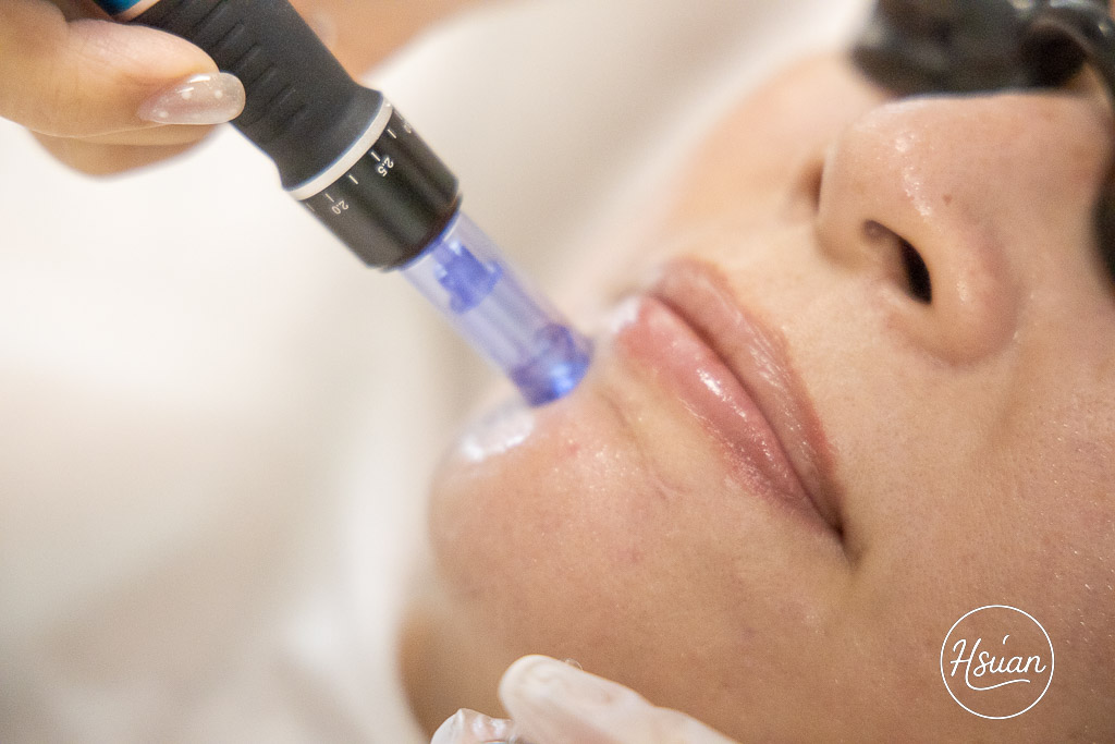 新竹韓式皮膚管理推薦｜聆癒H&bull;STUDIO：非侵入式液態皮秒+眼部SPA保養，告別暗沉粉刺，2小時打造透亮水光肌！ @About Hsuan美美媽咪親子美食旅遊