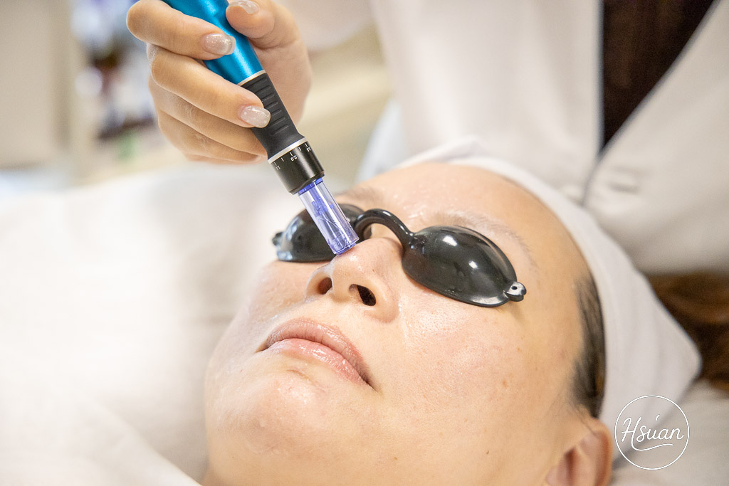 新竹韓式皮膚管理推薦｜聆癒H&bull;STUDIO：非侵入式液態皮秒+眼部SPA保養，告別暗沉粉刺，2小時打造透亮水光肌！ @About Hsuan美美媽咪親子美食旅遊